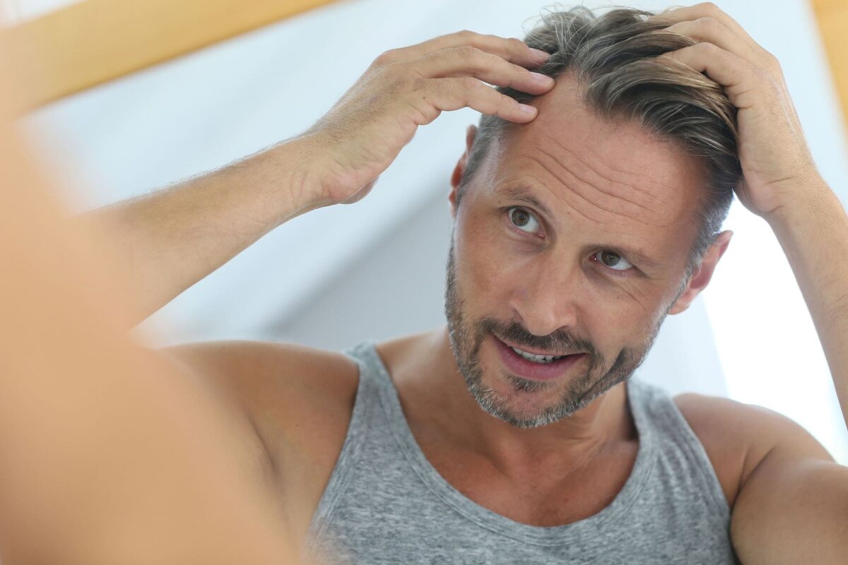 Photo d'homme montrant sa perte de cheveux